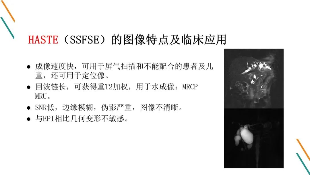影像PPT - 【PPT】腹部MRI扫描、增强期相及延迟扫描策略-21