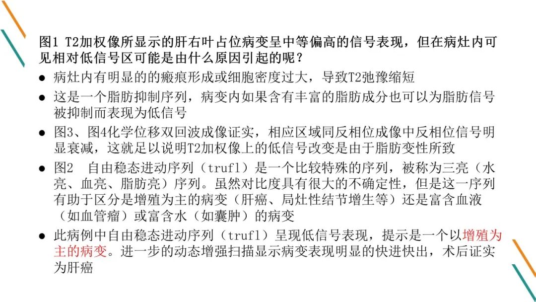 影像PPT - 【PPT】腹部MRI扫描、增强期相及延迟扫描策略-26