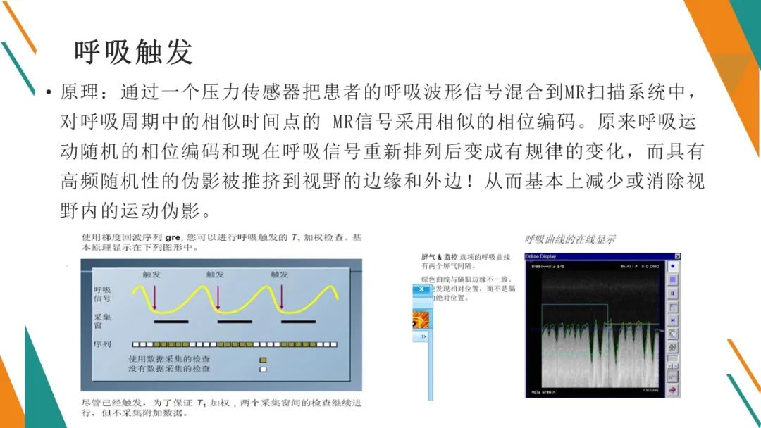 影像PPT - 【PPT】腹部MRI扫描、增强期相及延迟扫描策略-30