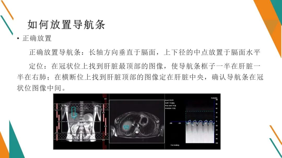 影像PPT - 【PPT】腹部MRI扫描、增强期相及延迟扫描策略-32
