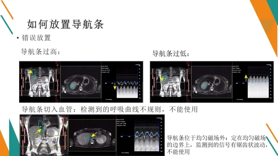 影像PPT - 【PPT】腹部MRI扫描、增强期相及延迟扫描策略-33