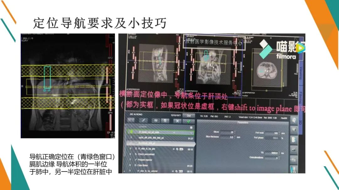 影像PPT - 【PPT】腹部MRI扫描、增强期相及延迟扫描策略-34