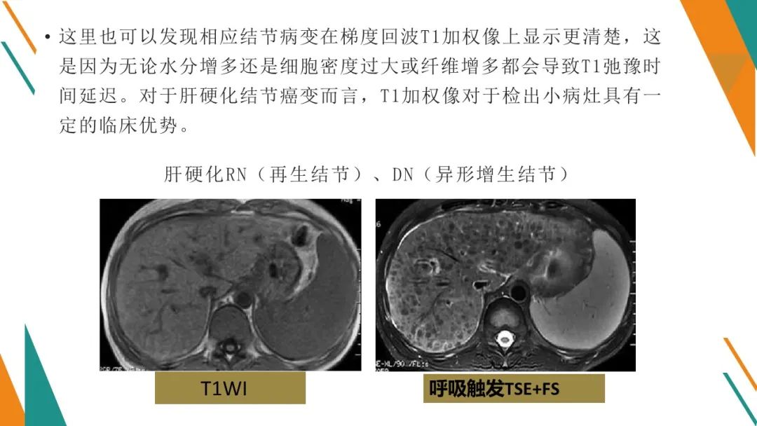 影像PPT - 【PPT】腹部MRI扫描、增强期相及延迟扫描策略-37