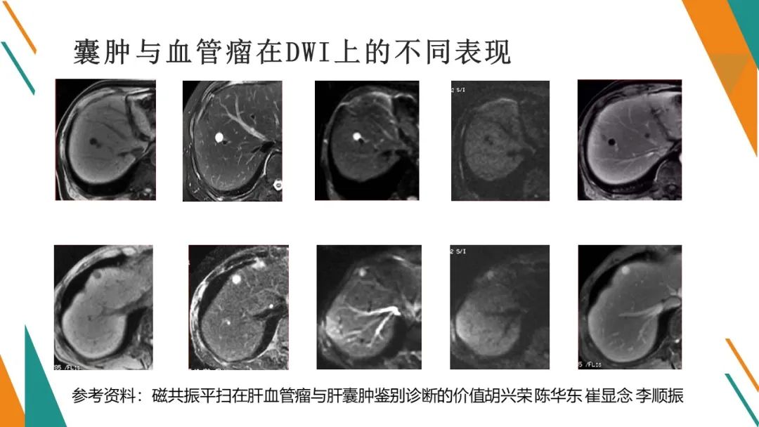 影像PPT - 【PPT】腹部MRI扫描、增强期相及延迟扫描策略-46