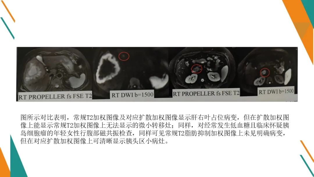 影像PPT - 【PPT】腹部MRI扫描、增强期相及延迟扫描策略-48
