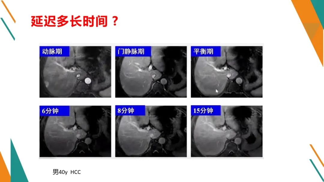 影像PPT - 【PPT】腹部MRI扫描、增强期相及延迟扫描策略-64