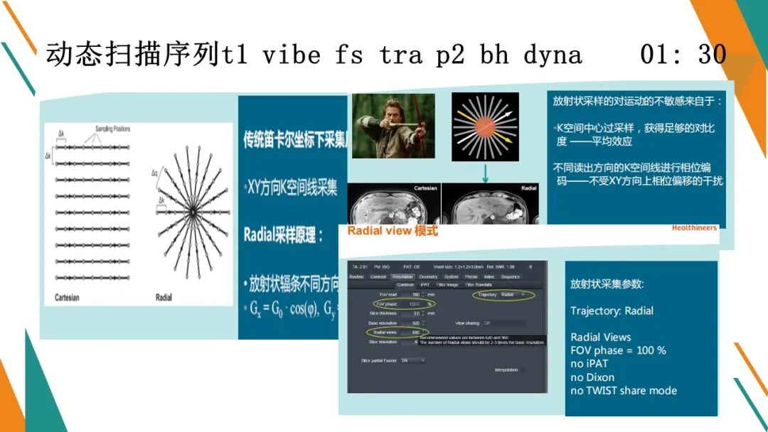 影像PPT - 【PPT】腹部MRI扫描、增强期相及延迟扫描策略-61