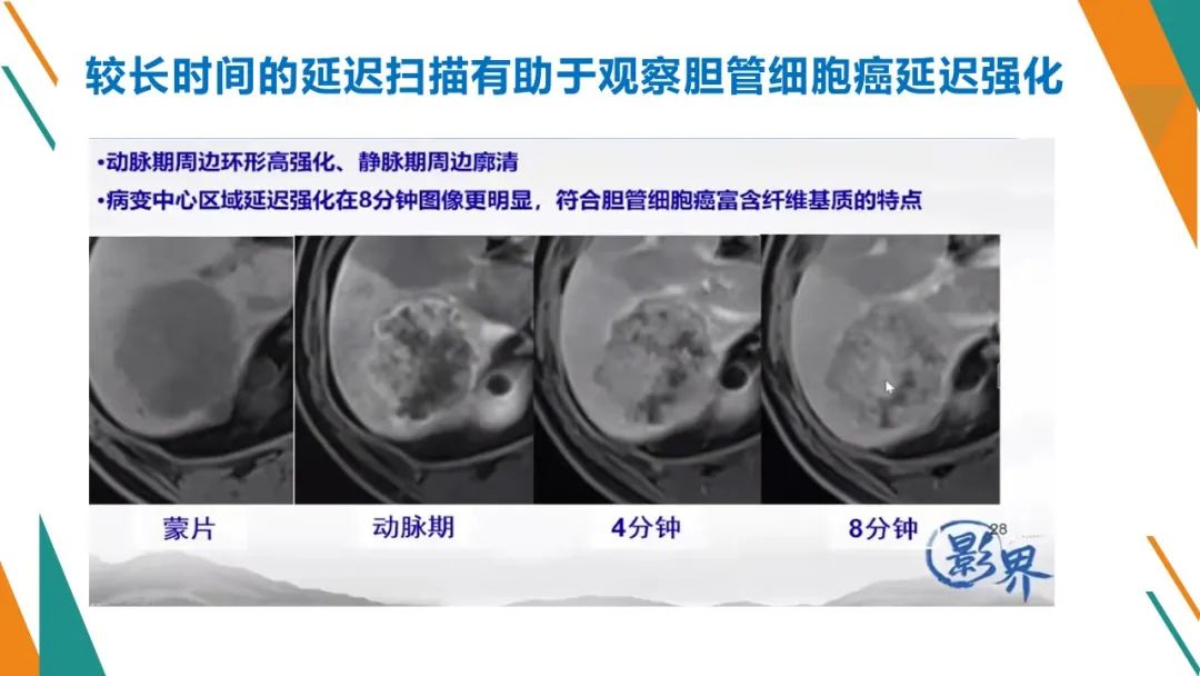 影像PPT - 【PPT】腹部MRI扫描、增强期相及延迟扫描策略-65