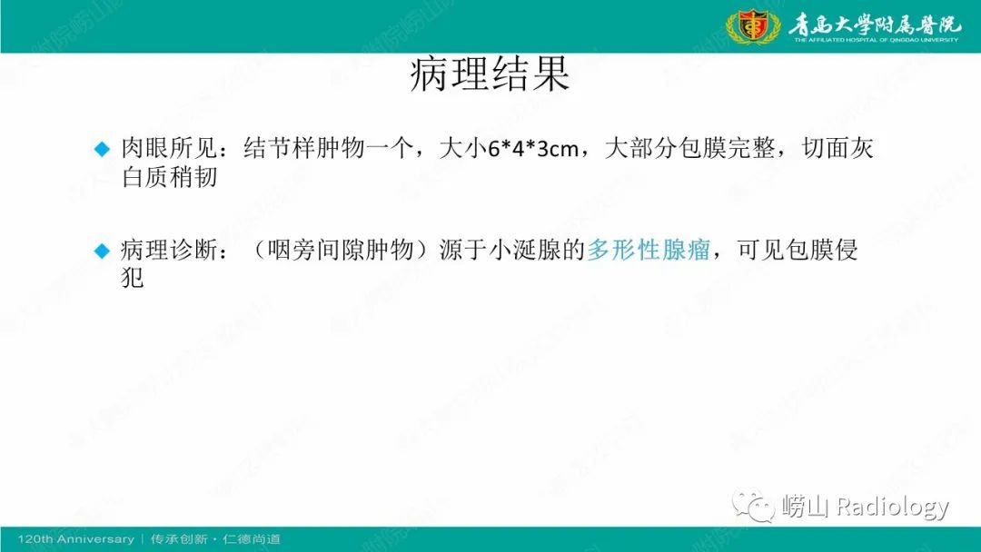 影像PPT - 【病例】多形性腺瘤1例CT及MR-7