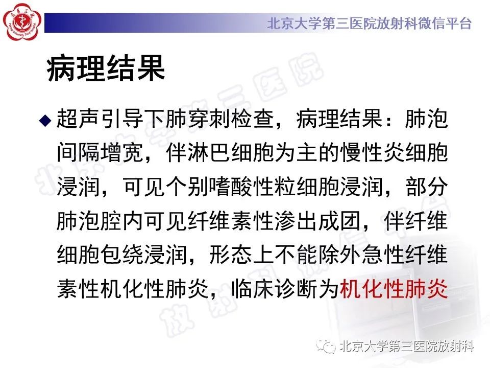 影像PPT - 【PPT】机化性肺炎-10