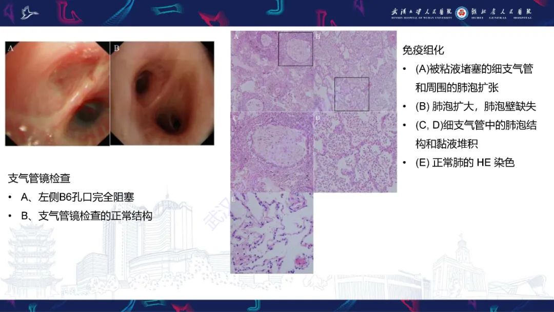 影像PPT - 【PPT】支气管闭锁影像诊断-15