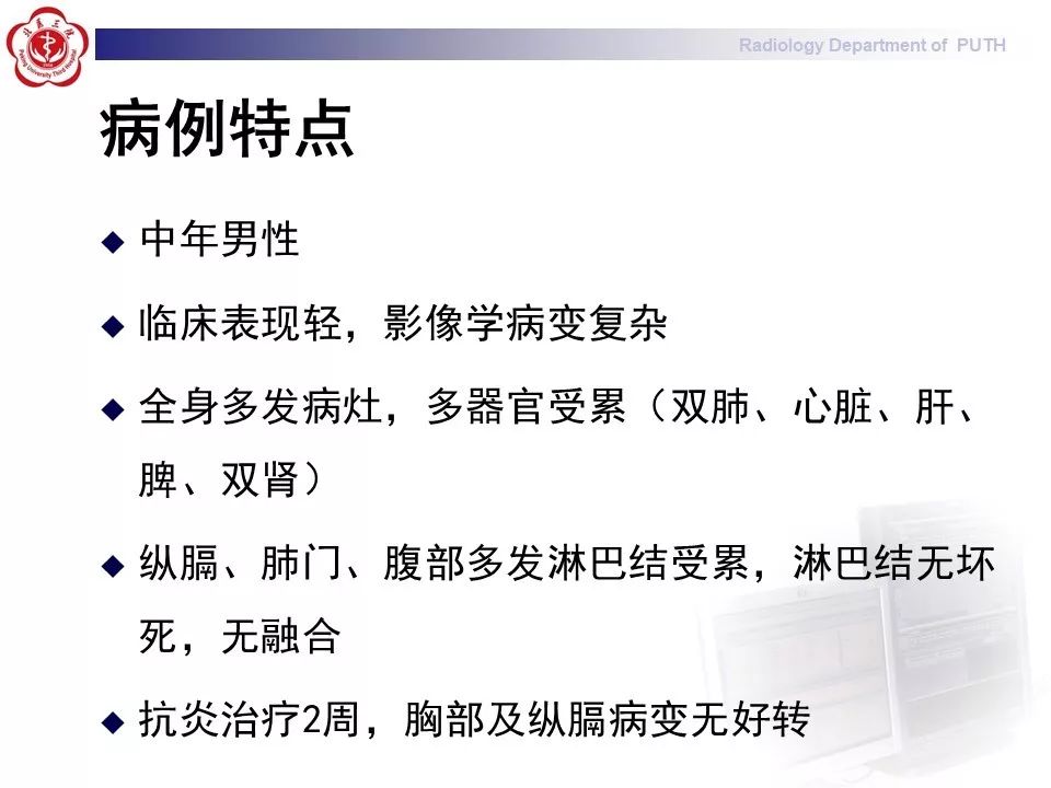 影像PPT - 【PPT】结节病（全身多系统受累）-13
