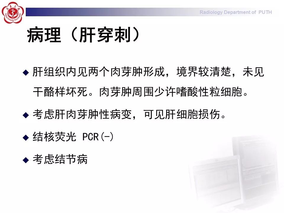 影像PPT - 【PPT】结节病（全身多系统受累）-14