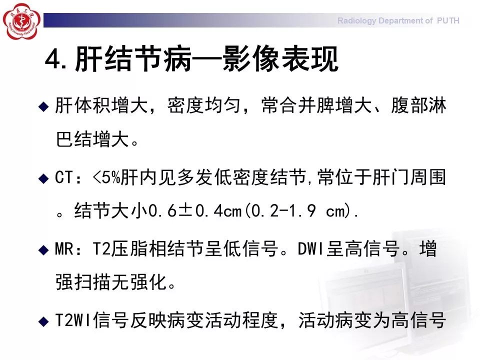 影像PPT - 【PPT】结节病（全身多系统受累）-25