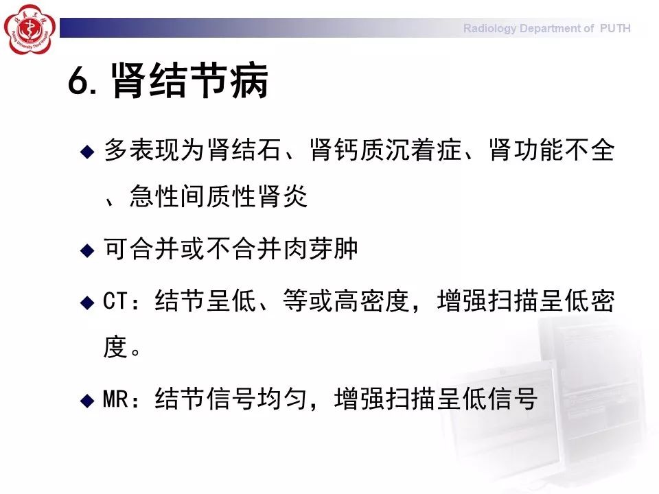 影像PPT - 【PPT】结节病（全身多系统受累）-32
