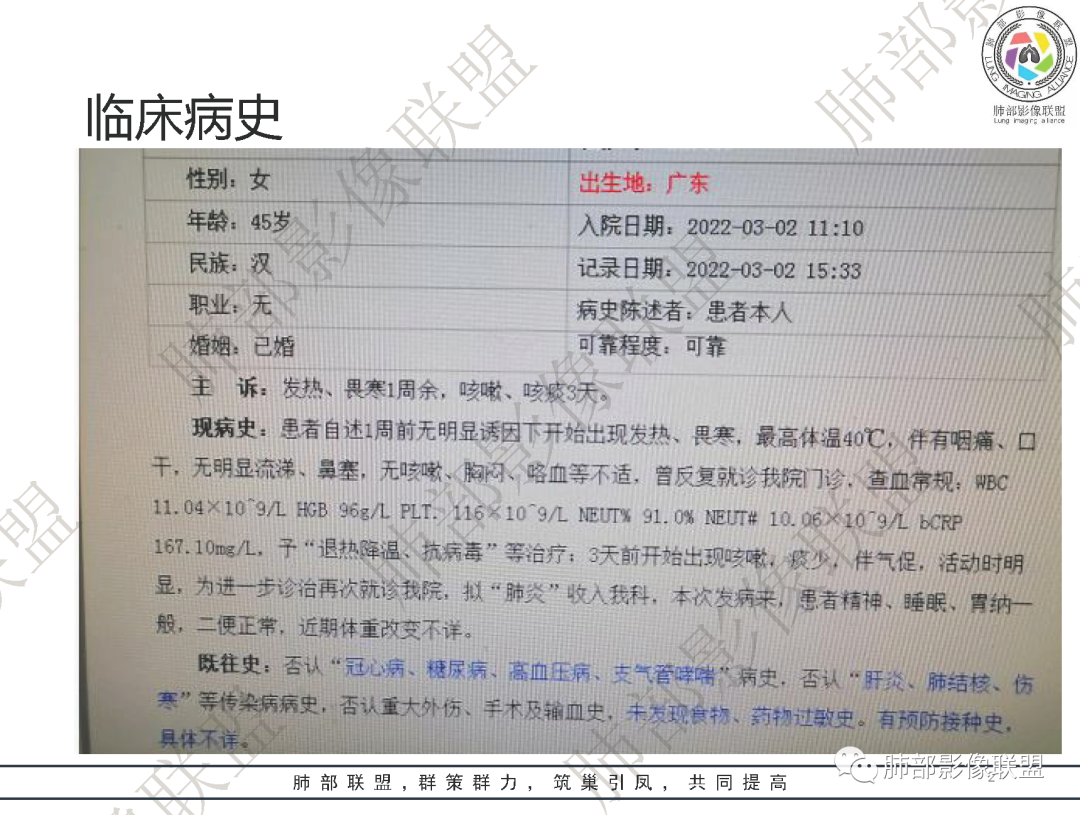 影像PPT - 【病例】鹦鹉热衣原体肺炎1例CT影像-2