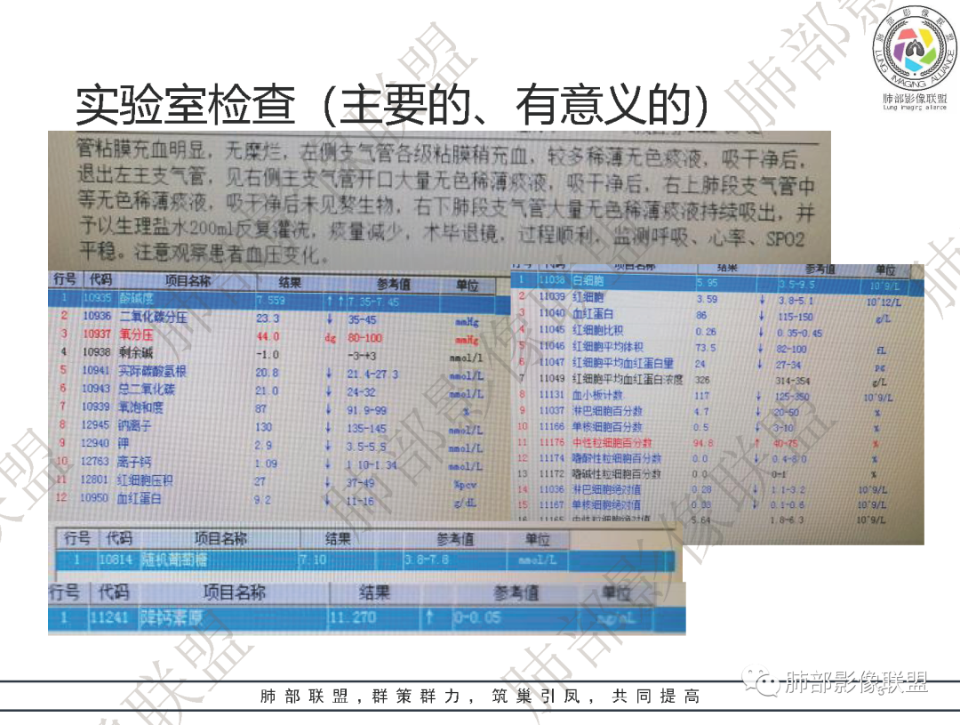 影像PPT - 【病例】鹦鹉热衣原体肺炎1例CT影像-3