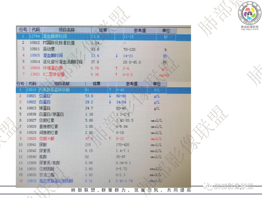 影像PPT - 【病例】鹦鹉热衣原体肺炎1例CT影像-4