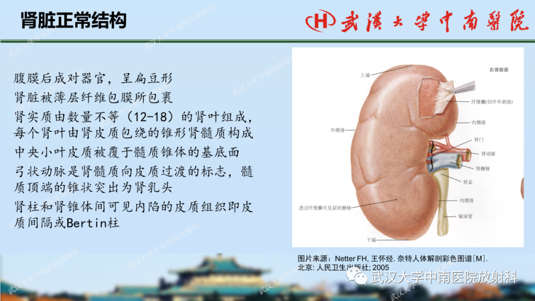 影像PPT - 【PPT】肾脏解剖、实性肾肿瘤-2