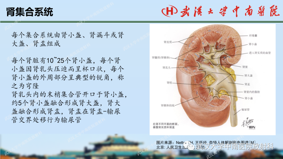 影像PPT - 【PPT】肾脏解剖、实性肾肿瘤-6