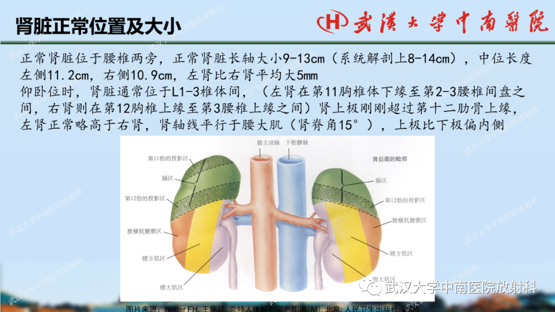 影像PPT - 【PPT】肾脏解剖、实性肾肿瘤-7