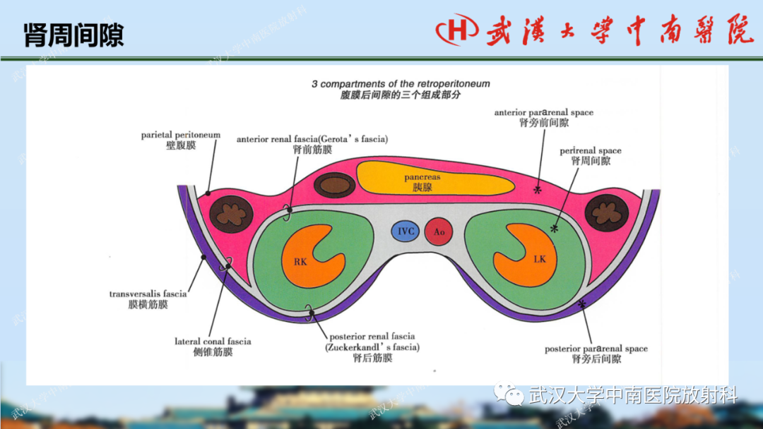 影像PPT - 【PPT】肾脏解剖、实性肾肿瘤-5