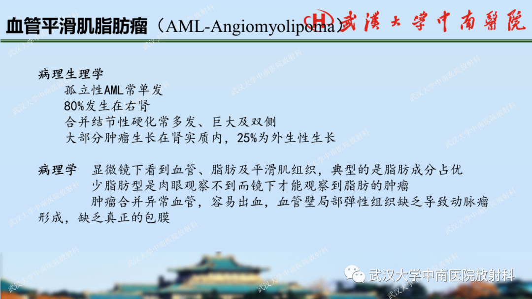 影像PPT - 【PPT】肾脏解剖、实性肾肿瘤-19