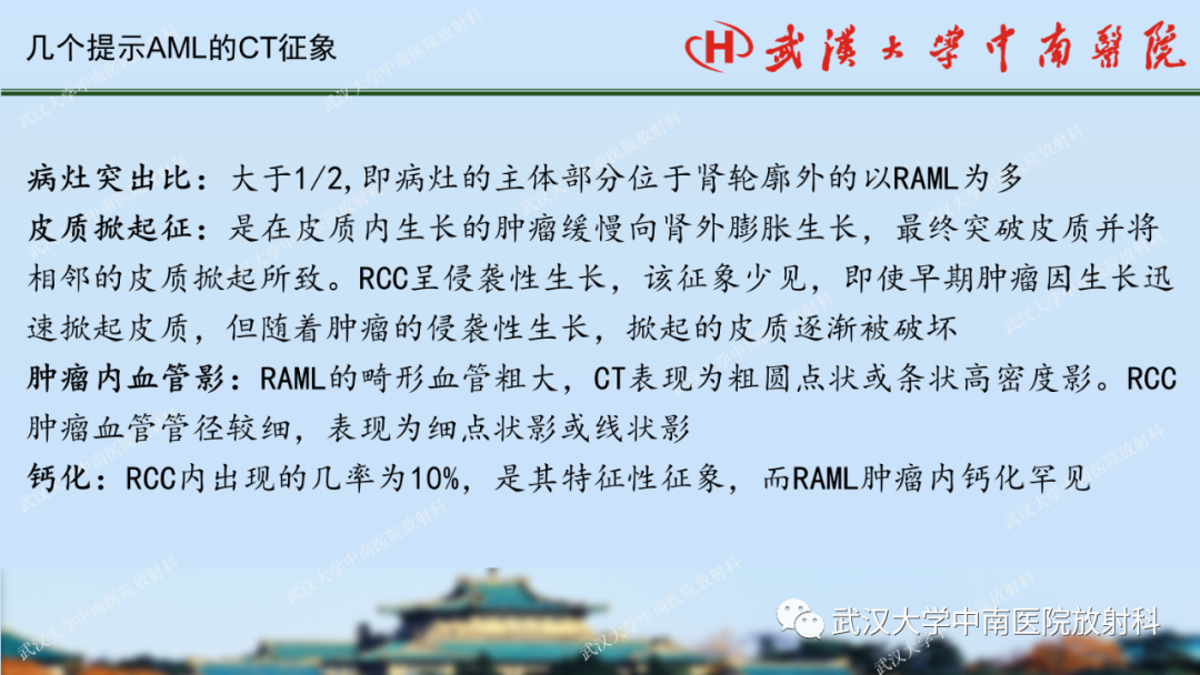 影像PPT - 【PPT】肾脏解剖、实性肾肿瘤-21
