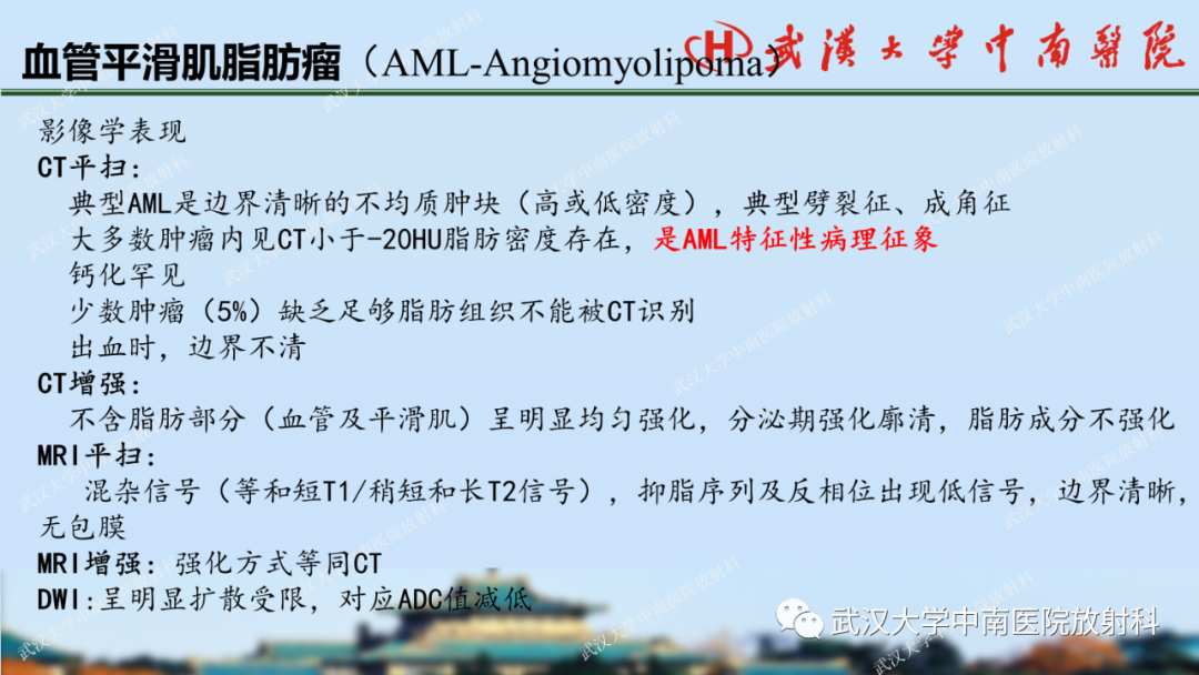 影像PPT - 【PPT】肾脏解剖、实性肾肿瘤-20