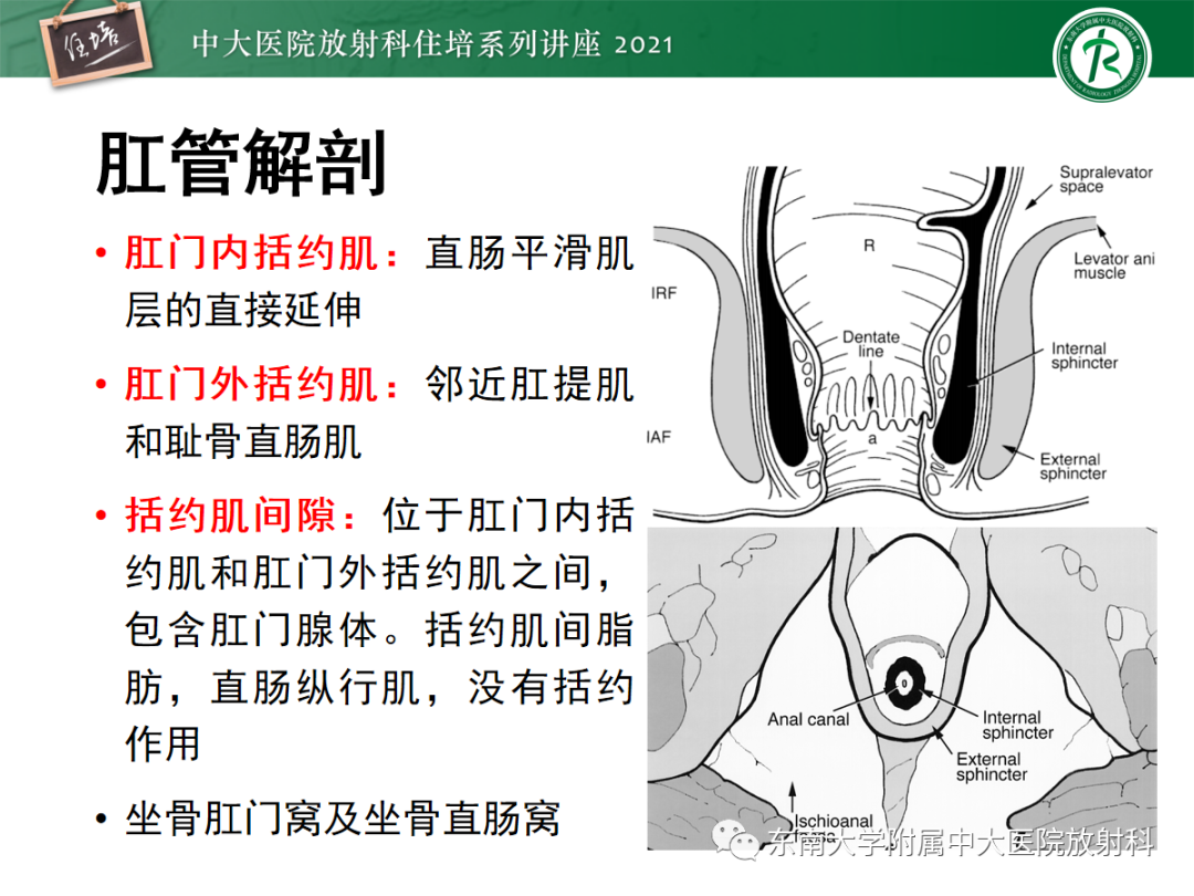 影像PPT - 【PPT】肛瘘的影像诊断及评估-4