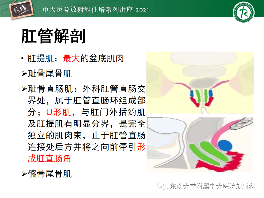 影像PPT - 【PPT】肛瘘的影像诊断及评估-5