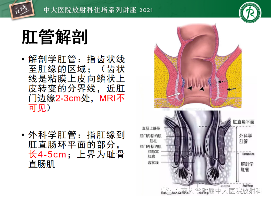 影像PPT - 【PPT】肛瘘的影像诊断及评估-3