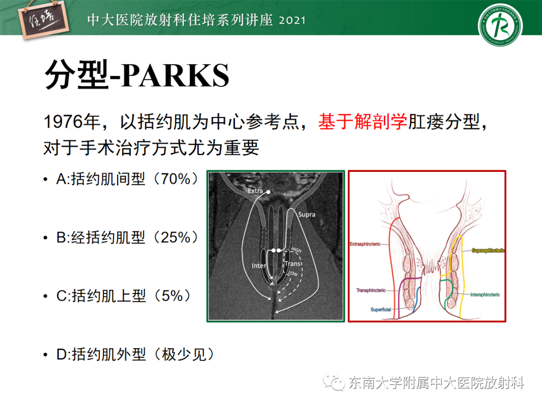 影像PPT - 【PPT】肛瘘的影像诊断及评估-20