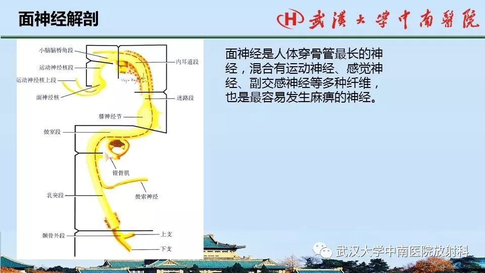 影像PPT - 【病例】中耳胆脂瘤1例CT及MR影像诊断与鉴别-11