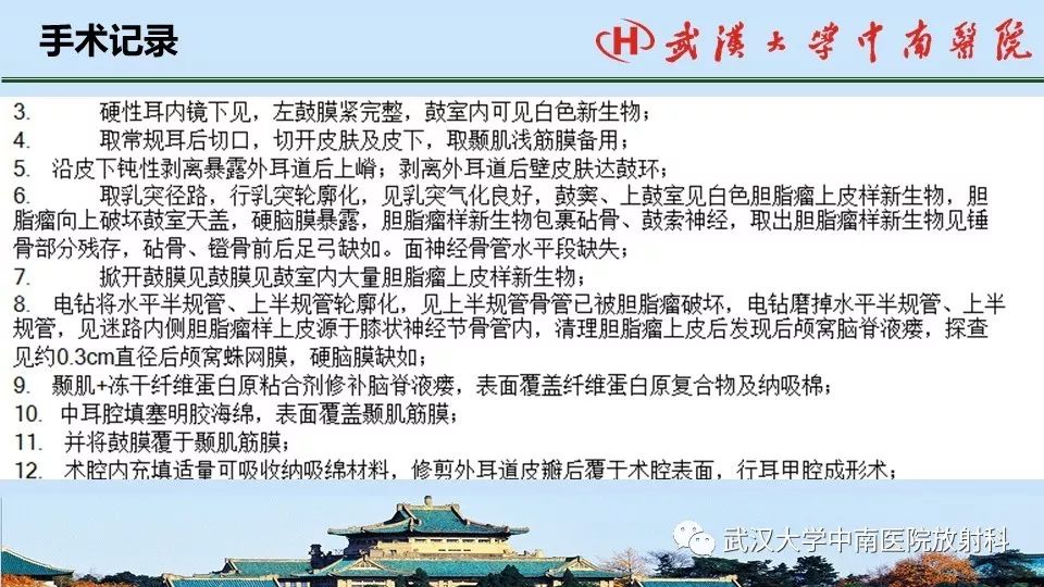 影像PPT - 【病例】中耳胆脂瘤1例CT及MR影像诊断与鉴别-19