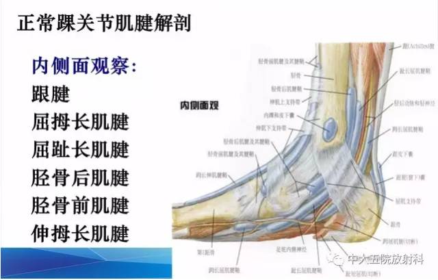 影像PPT - 【PPT】踝关节常见损伤的影像诊断-35