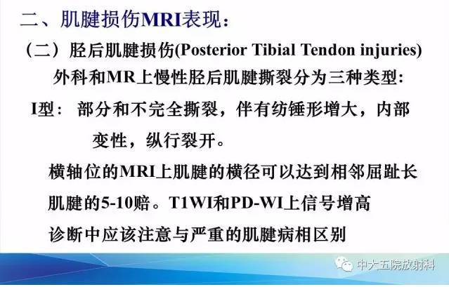 影像PPT - 【PPT】踝关节常见损伤的影像诊断-51