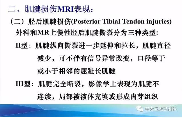 影像PPT - 【PPT】踝关节常见损伤的影像诊断-52
