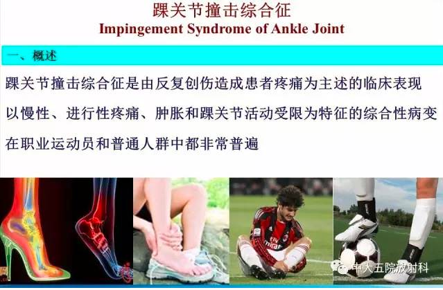 影像PPT - 【PPT】踝关节常见损伤的影像诊断-71