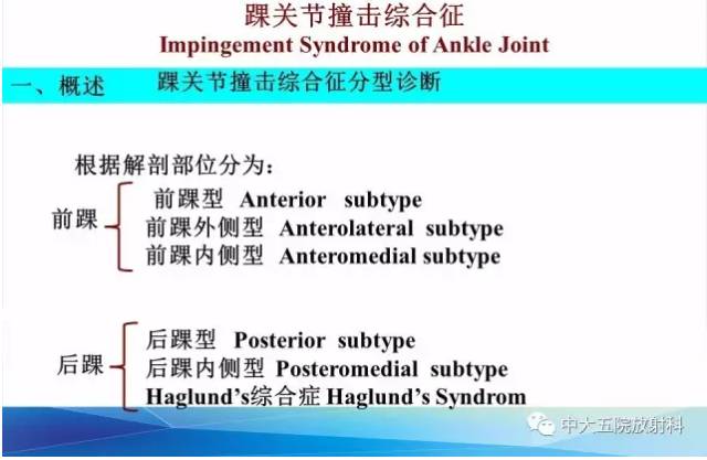 影像PPT - 【PPT】踝关节常见损伤的影像诊断-76