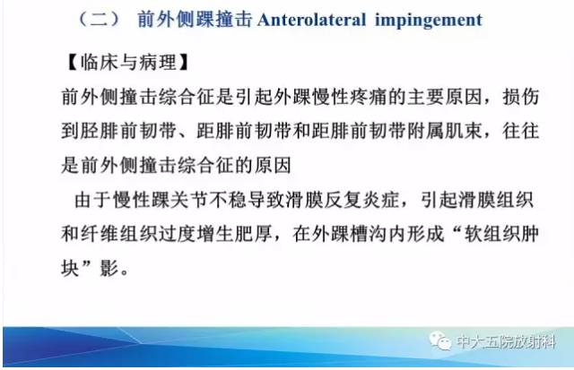 影像PPT - 【PPT】踝关节常见损伤的影像诊断-93