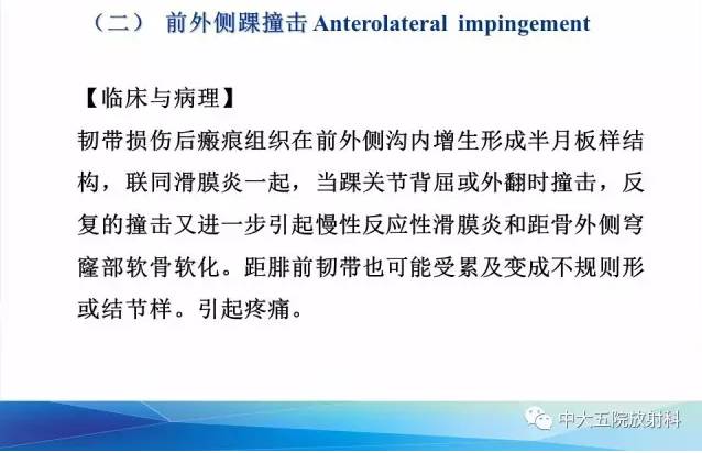 影像PPT - 【PPT】踝关节常见损伤的影像诊断-94