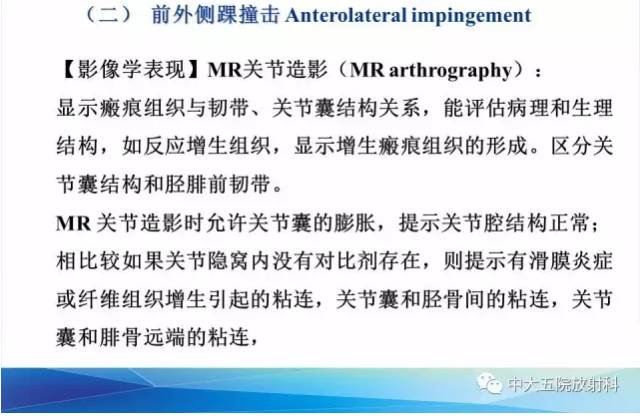 影像PPT - 【PPT】踝关节常见损伤的影像诊断-101