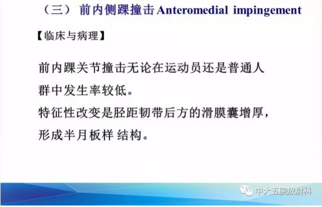 影像PPT - 【PPT】踝关节常见损伤的影像诊断-112