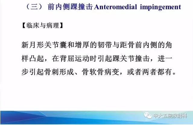 影像PPT - 【PPT】踝关节常见损伤的影像诊断-114
