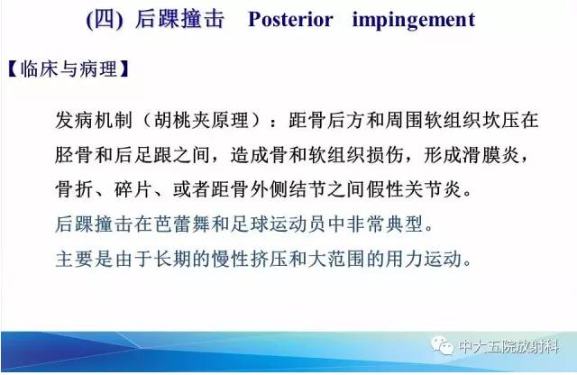 影像PPT - 【PPT】踝关节常见损伤的影像诊断-125