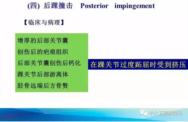 影像PPT - 【PPT】踝关节常见损伤的影像诊断-126