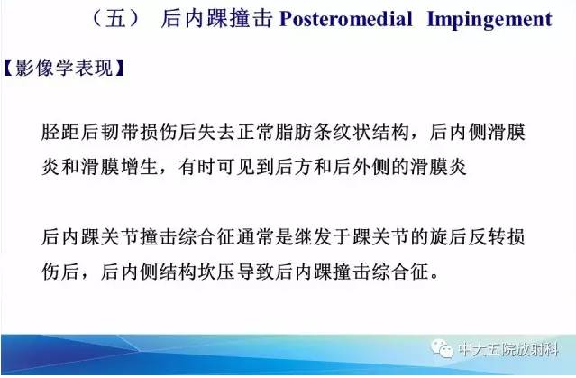 影像PPT - 【PPT】踝关节常见损伤的影像诊断-139