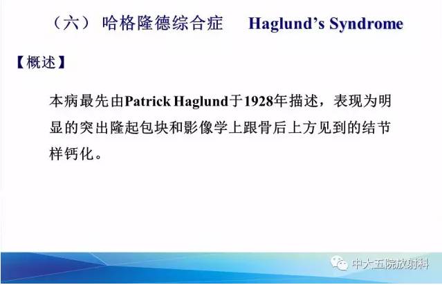 影像PPT - 【PPT】踝关节常见损伤的影像诊断-141