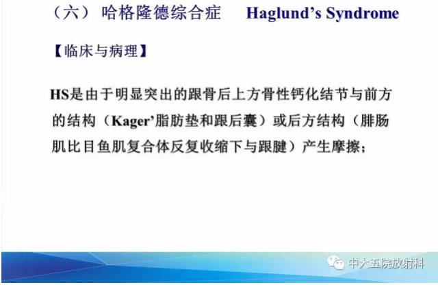 影像PPT - 【PPT】踝关节常见损伤的影像诊断-142